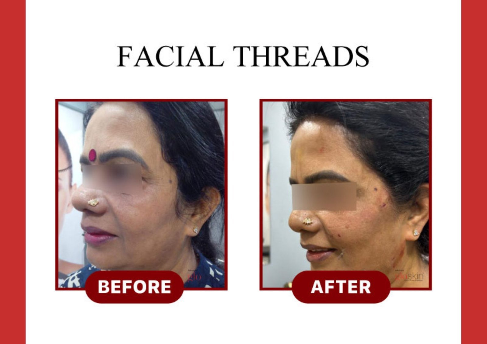 Facial-Threads.jpg