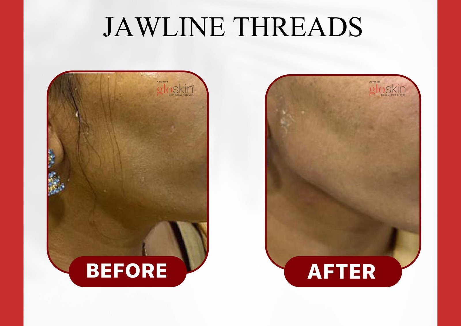 Jawline-Threads.jpg