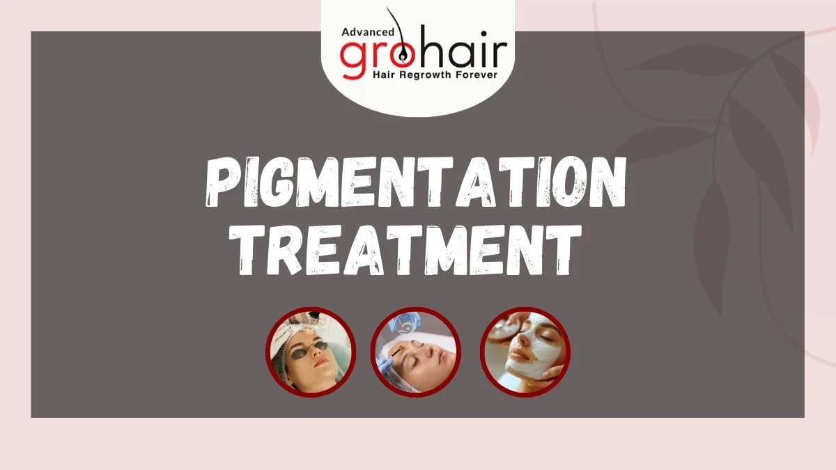 Pigmentation Treatment in Coimbatore