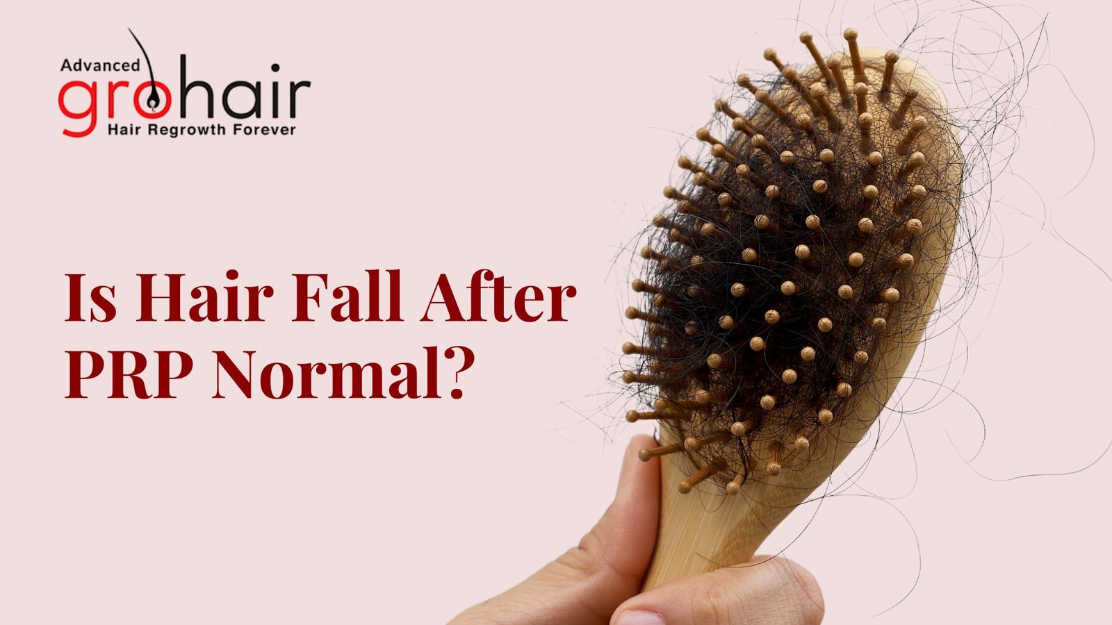 Is Hair Fall After PRP Normal